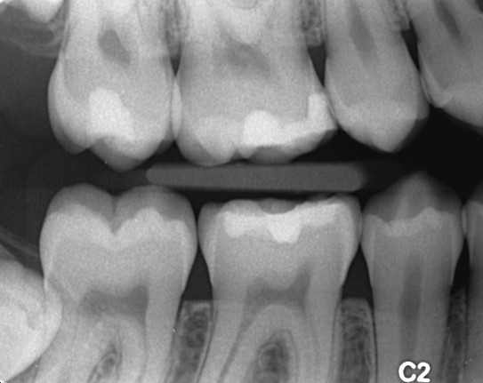 Hvornår skal der bores?