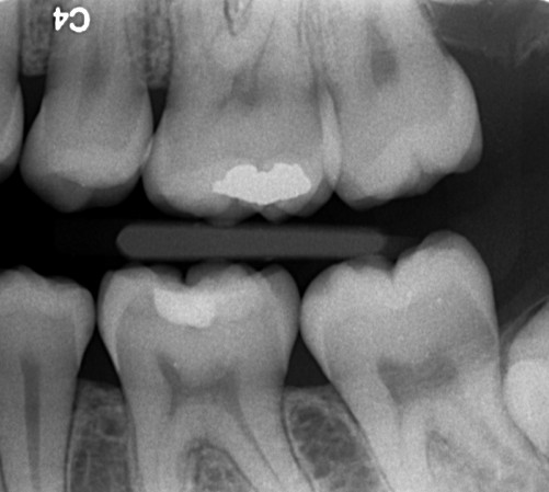 Hvornår skal der bores?2