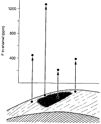 Emaljens fluorindhold
Dental Caries The Disease and its Clinical Management, Second Edition
Edited by Ole Fejerskov and Edwina Kidd
