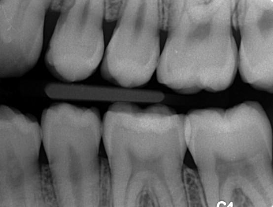 Hvornår skal der bores?3