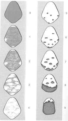 Thylstrup og Fejerskov
Dental Fluorose indeks